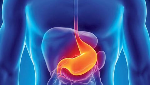 आम्लपित्ताचा त्रास, ही पथ्ये पाळा!