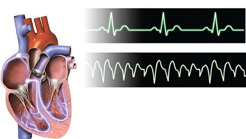टेककार्डिया ची समस्या?