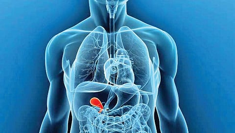 पित्ताशयाच्या समस्या : या आहाराचे सेवन करत असाल तर सावधान