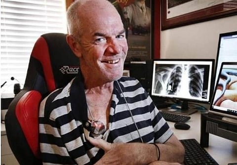 आश्चर्यच! पक्षाघात झालेल्या आजोबांनी मेंदूतील चीपने केले ट्वीट