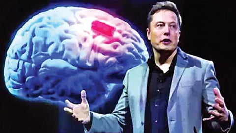 एलन मस्क : पुढील वर्षी मानवी मेंदूत बसवणार चिप