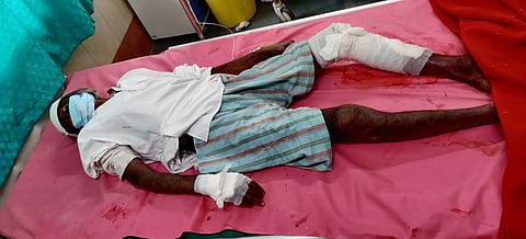 पुणे : तरसच्या हल्ल्यात कुत्रा, शेळ्या धावल्या मालकाच्या मदतीला