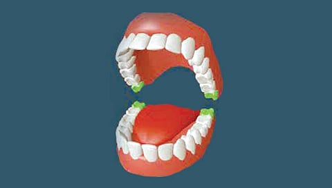 अक्कलदाढेने खरंच अक्कल येते?