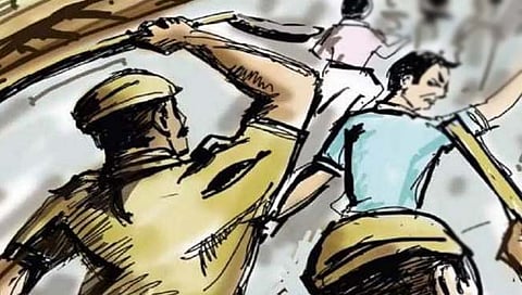 सावियो आलेमाव यांच्याआक्षेपार्ह विधानाने हाऊजिंग बोर्ड भागात तणाव; पोलिसांचा लाठीचार्ज