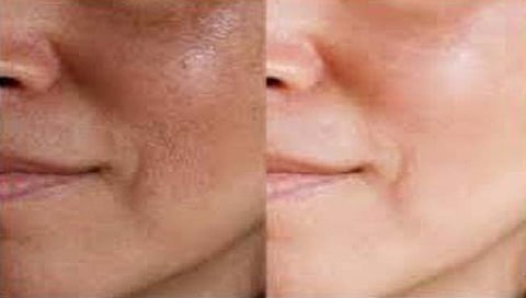 skin scrubber cream : मृत त्वचा (Dead skin) काढून टाकण्यासाठी ‘हे’ घरगुती उपाय करा