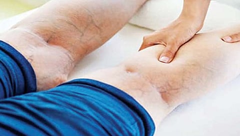 समस्या ‘सीव्हीआय’ची, काय आहे कारण?