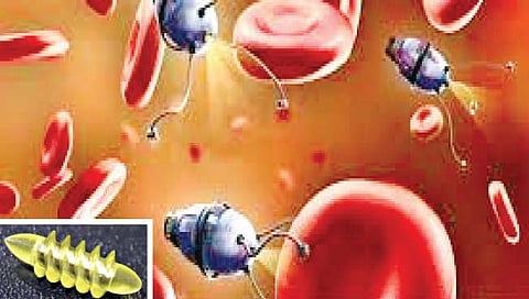 मेंदूत शिरून ‘सर्जरी’ करेल रोबोट!