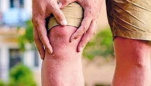 मूत्रपिंड, सांध्यांच्या समस्यांकडे दुर्लक्ष नको; पावसाळ्यात अधिक काळजी घेण्याचा डॉक्टरांचा सल्ला