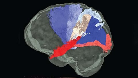मेंदूच्या ‘कनेक्टिव्हिटी’ला दाखवणारे नवे अ‍ॅल्गोरिदम
