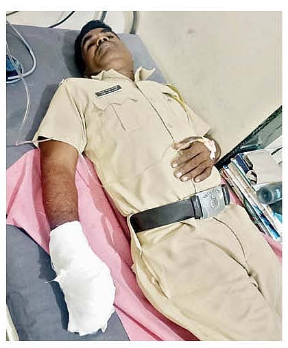 मारहाणीत जखमी झालेला पोलिस कर्मचारी