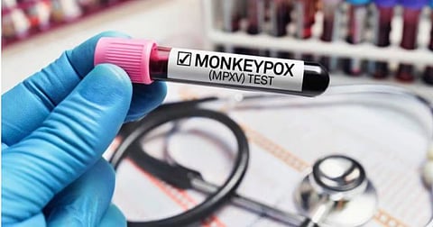 संग्रहित छायाचित्र