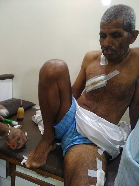 सोनजांब : बिबट्याच्या हल्ल्यात जखमी झालेले शेतकरी बाकेराव हरी जाधव. (छाया: समाधान पाटील)