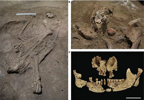 शस्त्रक्रिया करून पाय काढलेला 31 हजार वर्षांपूर्वीचा सांगाडा सापडला