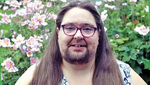 ‘या’ विकाराबाबत जनजागृतीसाठी ‘तिने’ कापली आपली दाढी!