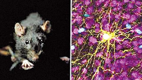 मानवी मेंदूच्या पेशींचे उंदराच्या मेंदूत प्रत्यारोपण