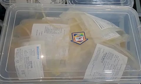 Fake Blood Platelets : प्रयागराजमध्ये ‘ब्लड प्लेटलेट्स’ ऐवजी चढवलं ‘मोसंबी ज्यूस’; रुग्णाचा मृत्यू, १० जणांना अटक