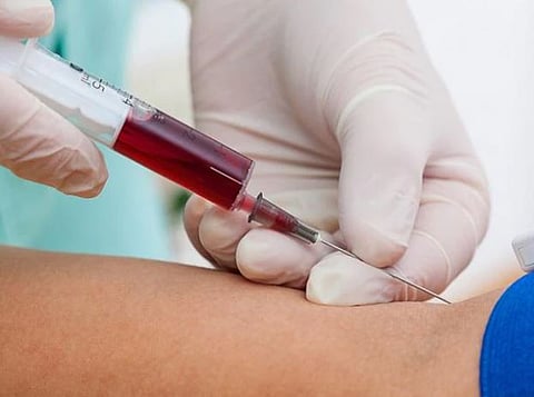 Lab-grown blood : प्रयोगशाळेमध्ये निर्मित रक्‍ताची मानवावर चाचणी सुरु : ब्रिटनमध्ये जगातील पहिली क्लिनिकल ट्रायल