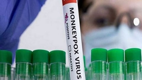 ‘WHO’ मंकी पॉक्सचे नाव बदलून ‘एम पॉक्स’ करणार!