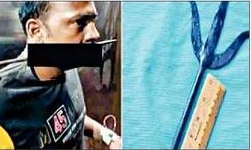 गळ्यातील आरपार त्रिशुळासह ६५ कि.मी. प्रवास करूनही तो बचावला