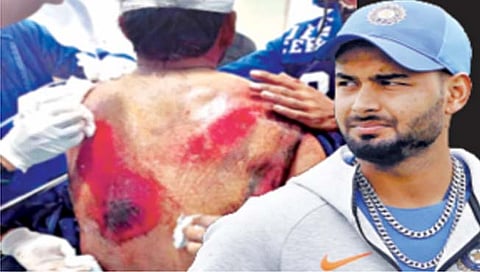 ऋषभ पंत याच्या कारकिर्दीला सेटबॅक