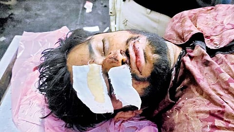 कोल्हापूर : टेंबलाईवाडी टेकडीनजीक अपघात; दुचाकीस्वाराला डंपरने फरफटत नेले