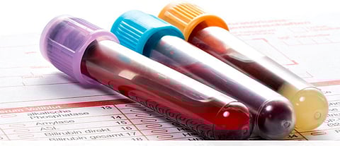 पुणे शहरातील अनधिकृत पॅथॉलॉजी लॅबवर होणार कारवाई