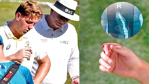 IND vs AUS Test : कॅमेरून ग्रीन पहिल्या कसोटीला मुकणार?