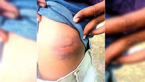 सांगली : अल्पवयीन विद्यार्थ्यांना अमानुष मारहाण ‘त्‍या’ रेक्टरवर कारवाईची मागणी