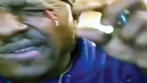 डोळ्यात फोडला फटाका