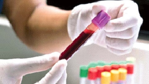 नव्या रक्त चाचणीतून होणार घाबरण्याच्या आजाराचे निदान