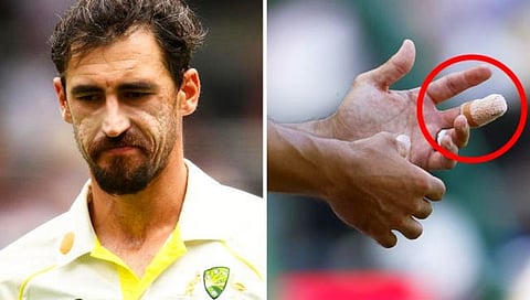 Mitchell Starc : जखमी बोटाने गोलंदाजी करून स्टार्कने दिले टीम इंडियाला आव्हान (व्हिडिओ)