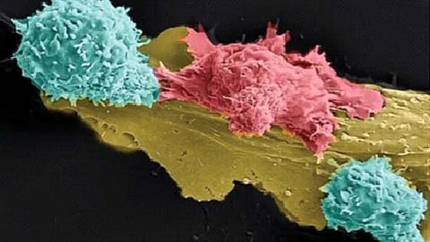 कर्करोगावर रामबाण उपाय 