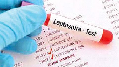 डबक्यांमुळे वाढली लेप्टोस्पायरोसिसची भीती