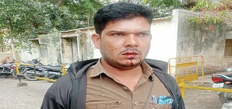 दौंड : प्रवाशाच्या मारहाणीत एसटीचा वाहक जखमी