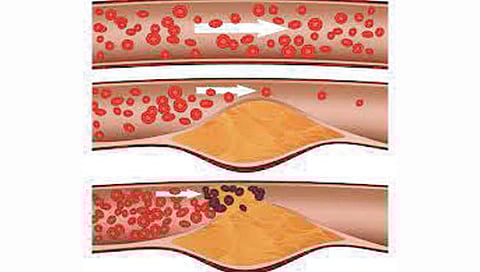 Cholesterol : ‘या’ पदार्थांमध्ये असते कोलेस्टेरॉल कमी करण्याची क्षमता