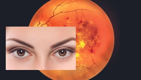 धोका डायबेटिक रेटिनोपॅथीचा, जाणून घ्‍या या विकाराविषयी…