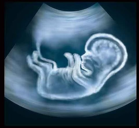 गर्भलिंग निदान रोखण्यासाठी राज्यात वर्षात ७१ स्टिंग ऑपरेशन