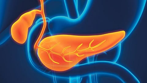 टाईप १ मधुमेहींसाठी स्वादुपिंड प्रत्यारोपणाचा पर्याय, जाणून घ्या त्याचे फायदे