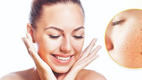 पिग्मेंटेशन आणि उपचार