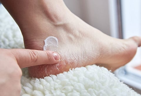 Crack heels : थंडीत दुखऱ्या आणि चिरलेल्या टाचांपासून आराम मिळवण्यासाठी हे उपाय करा