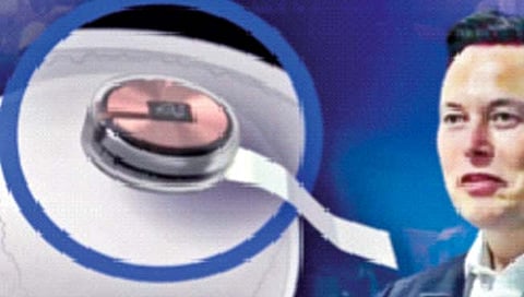 मेंदूतील चिपने काय साधणार?