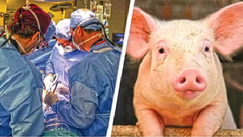 माणसाच्या शरीरात डुकराच्या किडनीचे प्रत्यारोपण