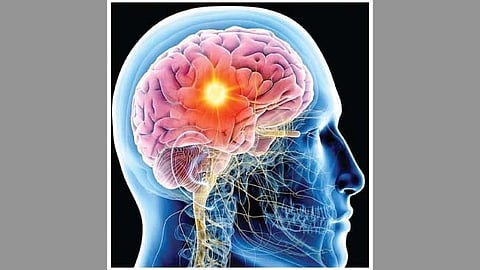 BPD  Health Problem |