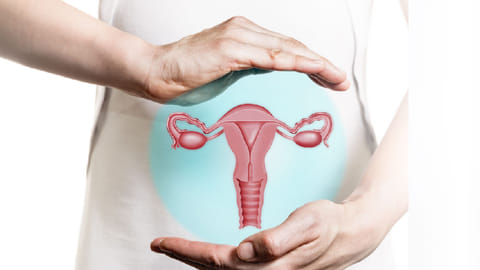 Cervical cancer