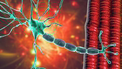 Guillain Barre Syndrome