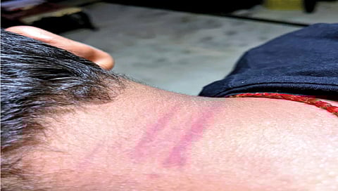 ninth-grade-student-brutally-beaten-by-teachers