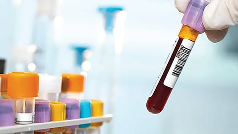 worlds-rarest-blood-group-found-in-only-one-woman