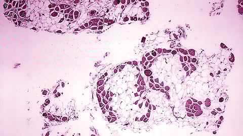 300-million-people-worldwide-suffer-from-rare-diseases