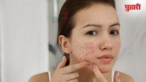 How To Get Even Skin Tone 