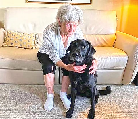 75-Year-Old Woman Sees World Again After Tooth Implanted in Eye Restores Vision